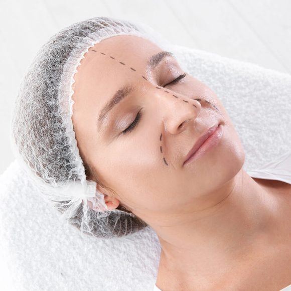 plastic surgery loan